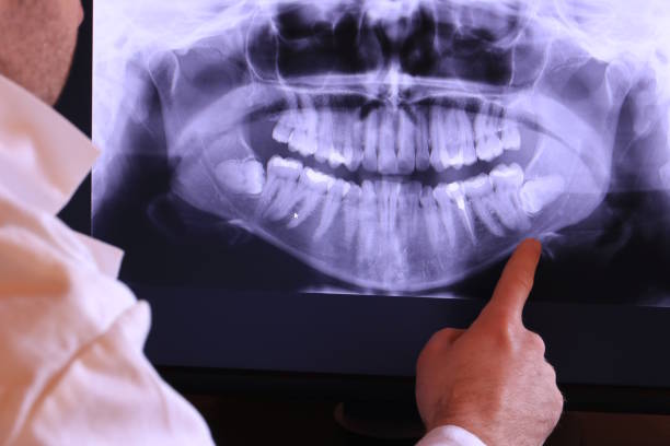 Best Emergency Cosmetic Dentistry (e.g., broken veneers) in Ciborne, LA