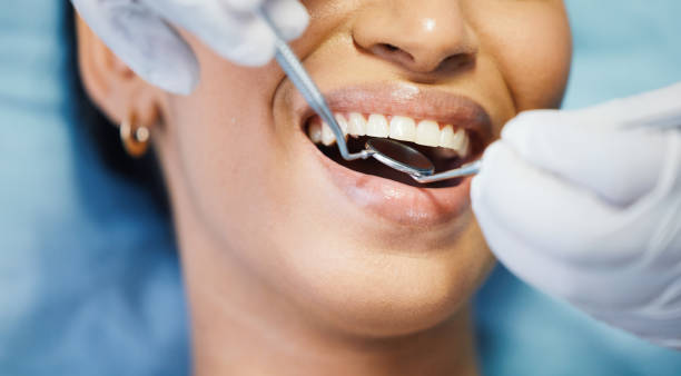 Best Lost Filling or Crown Replacement in Ciborne, LA
